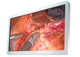 EIZO: Neue Monitorreihe für die Endoskopie